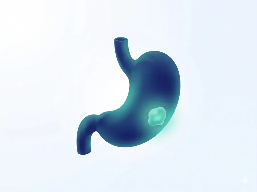 Stomach Cancer
