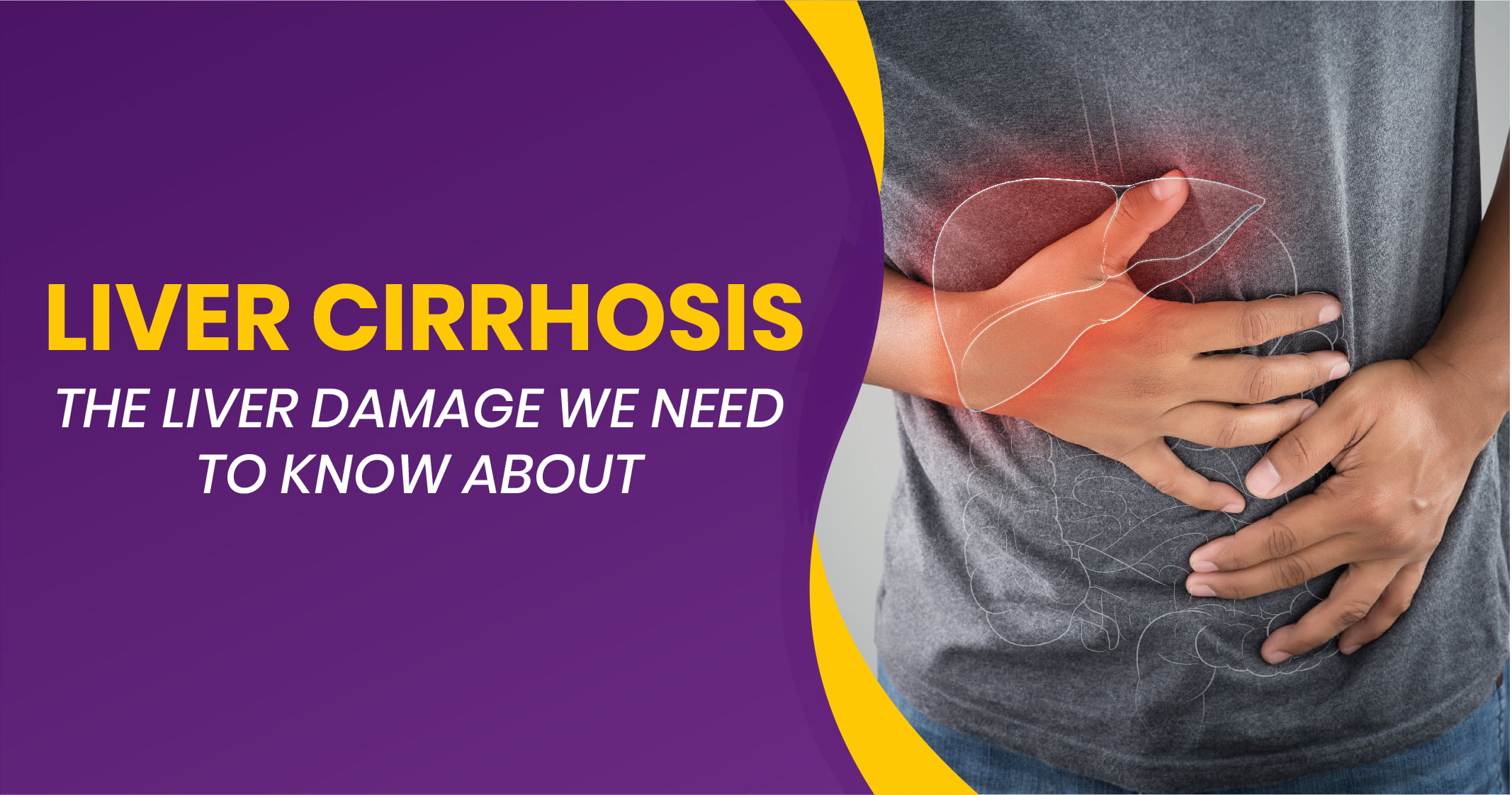 Liver Cirrhosis: Causes, Diagnosis, Treatment, and Prevention