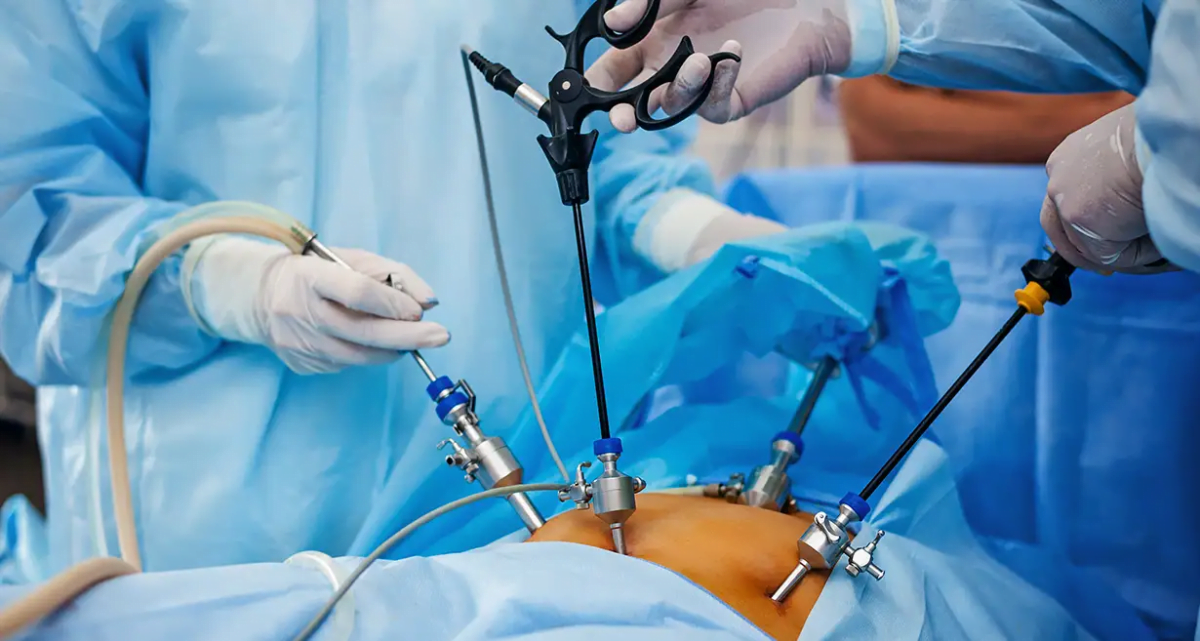 Surgeons performing laparoscopic surgery on a patient