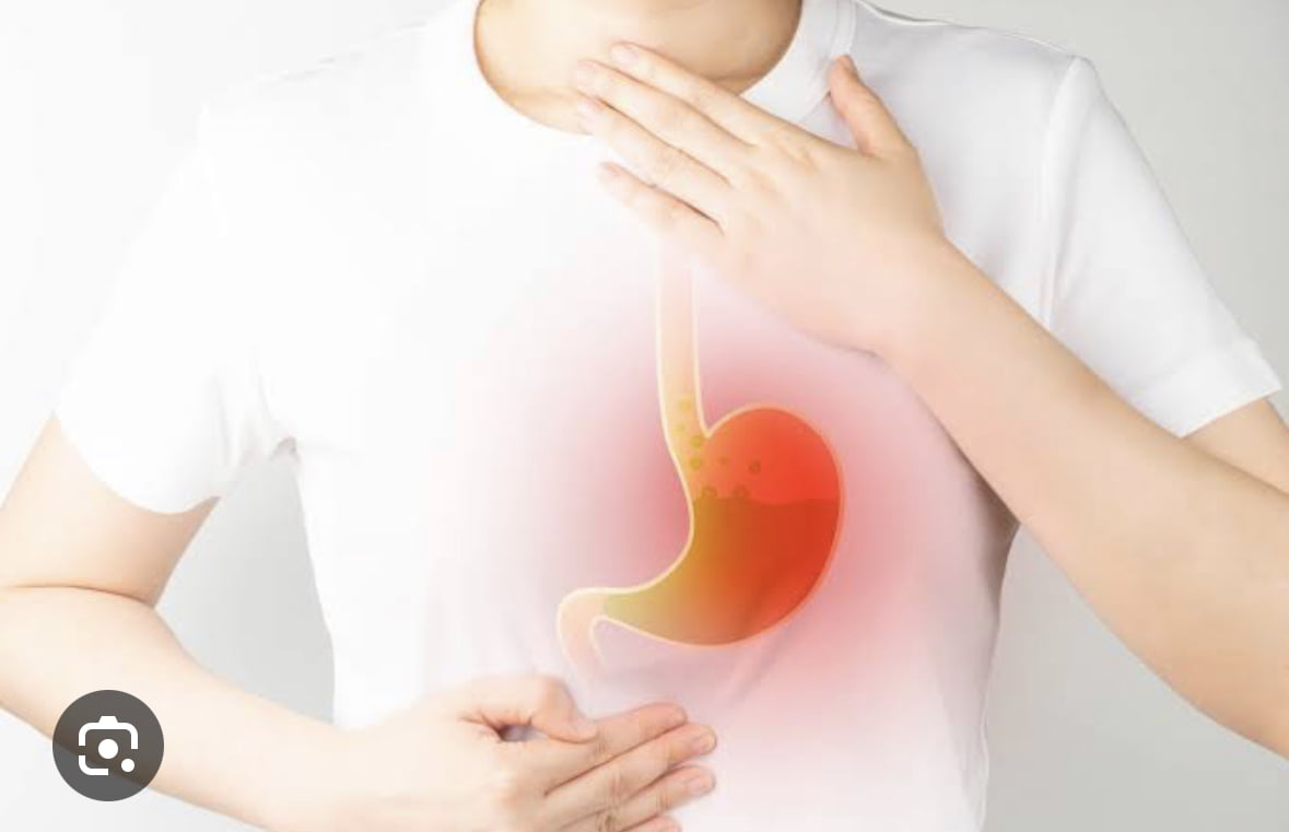 Complications of Reflux: Causes, Treatment, and Aftercare