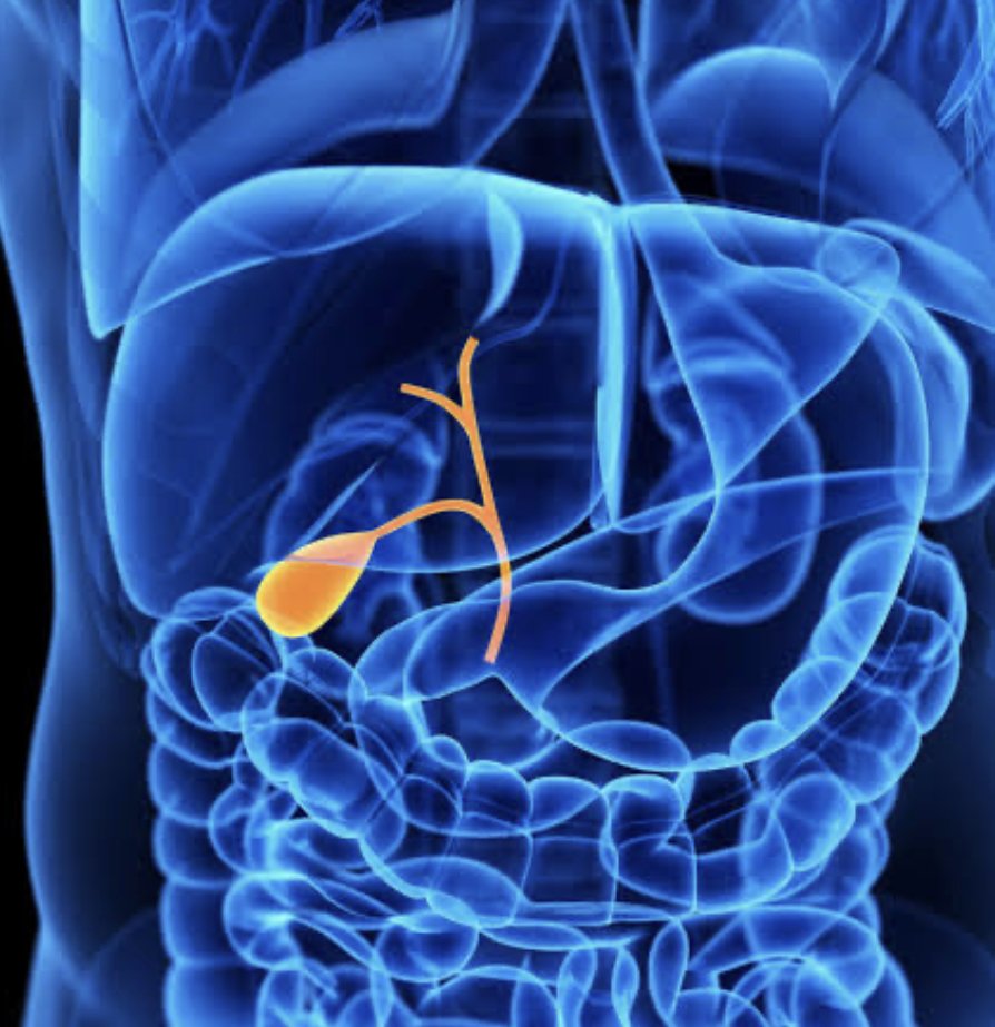 Complications of Untreated Gallbladder Stones