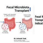 Fecal Microbiota Transplant (FMT): Process, Indication, Outcome.