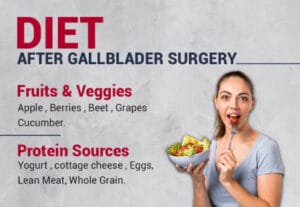 Diet after Gallbladder Removal Surgery