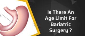 Age limit for Safe Weight Loss Surgery